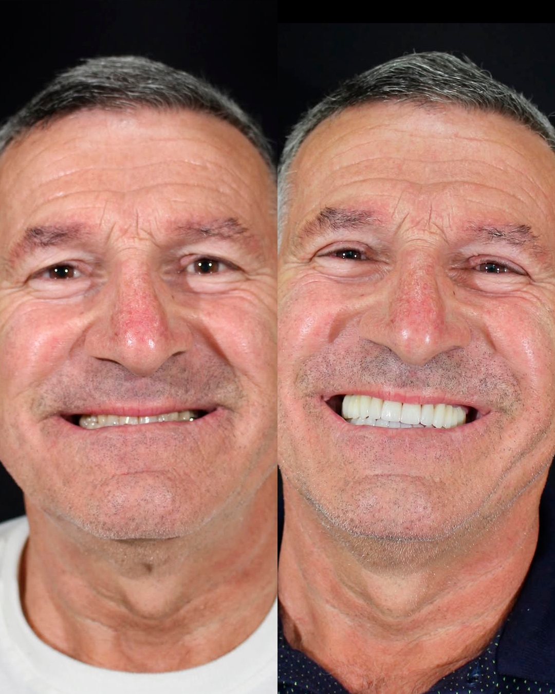 24366-53c5391e2b023655768659a2b2de522d